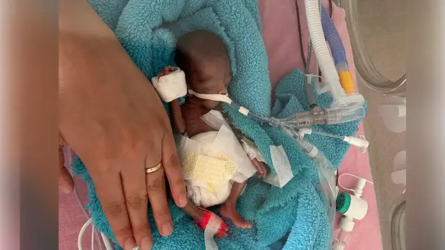В Айдыне родившийся с весом 350 граммов малыш Рюзгар выписан через 240 дней